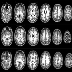 Brain scans from three ‘radicals’ who took part in the Barcelona studies. © Nafees Hamid and Clara Pretus