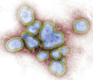 cdc us unprepared for outbreaks like coronavirus