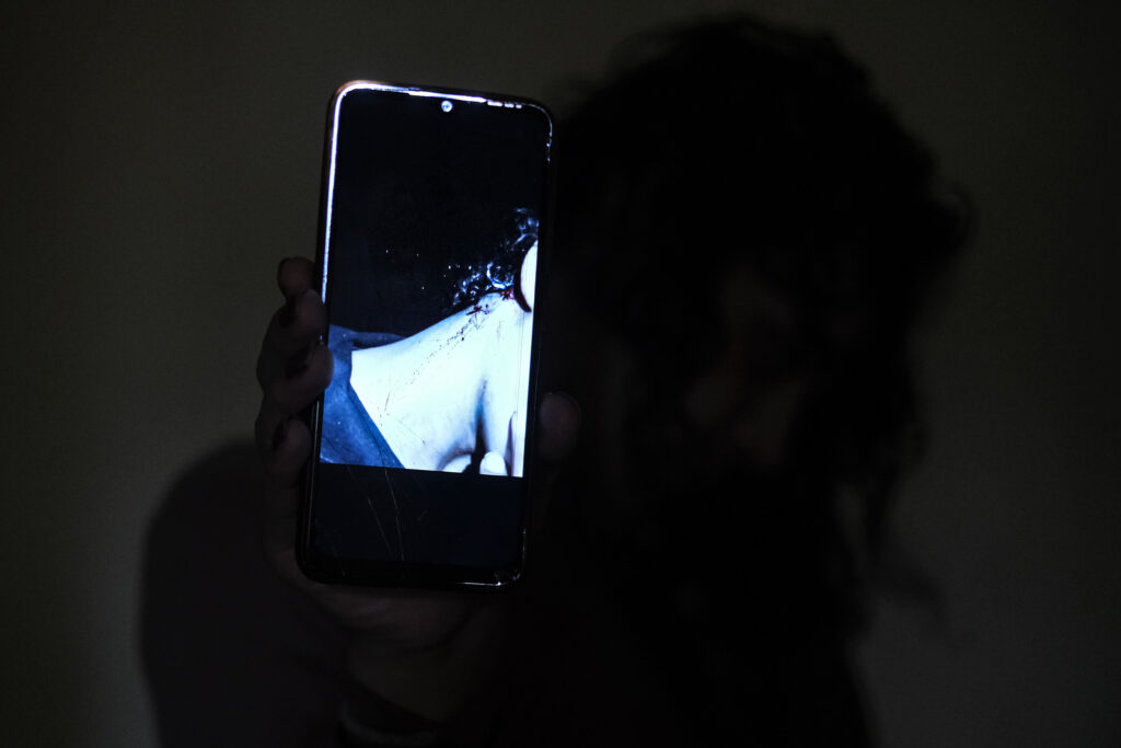 Maya shows a photo from the aftermath of when a Lebanese assailant beat her near the city of Tyre, targeting her because she is transgender (João Sousa)