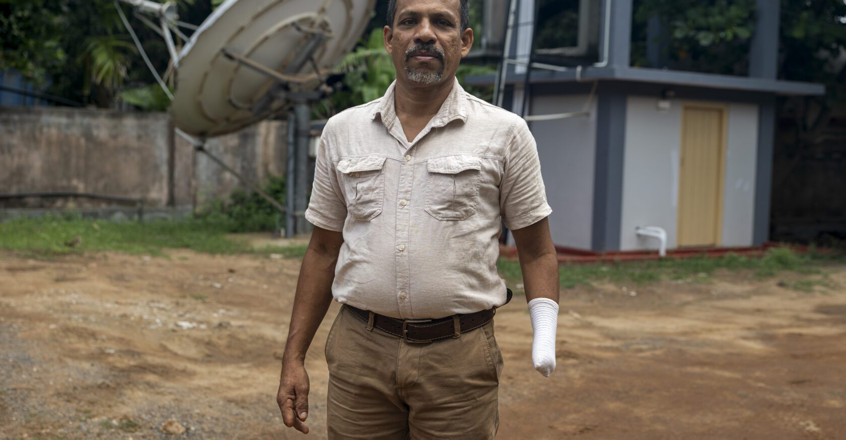 A man who lost a hand and several fingers on the other hand speaks of the landmine accident that left him injured (Dimitra Margariti)
